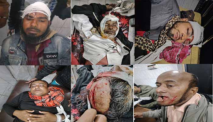 ভোলায় বিএনপি-জামায়াত সংঘর্ষে আহত ৩০